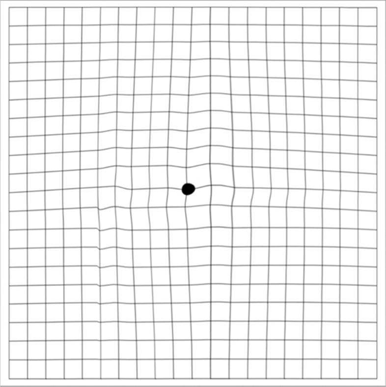 Amsler Grid